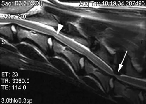 Syndrome de Wobbler chez le chien - Causes, symptômes et traitement - Qu'est-ce que le syndrome de Wobbler ou le syndrome du décalage ?